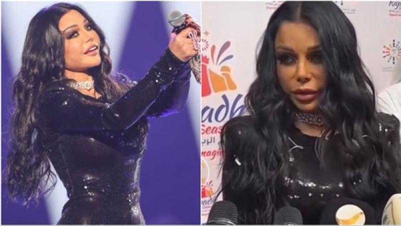 صدمة.. تشوه وجه هيفاء وهبي بسبب عمليات التجميل