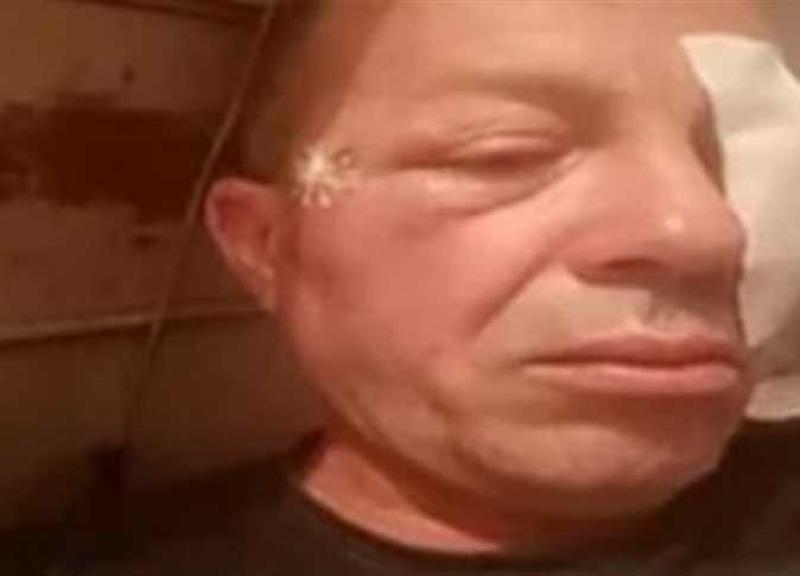 سائق قطار كفر الشيخ المصاب يكشف تفاصيل الاعتداء عليه