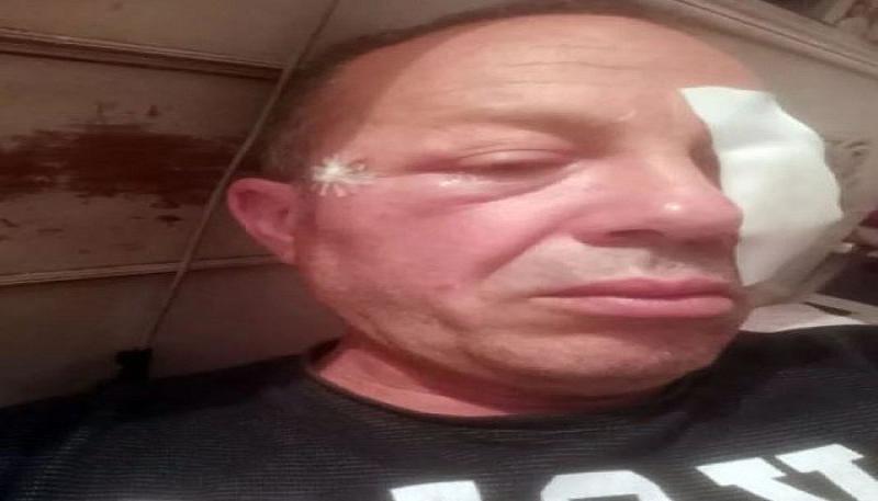 عمرو أديب عن واقعة سائق قطار شربين: ”يا كفرة حد يعمل كده”.. عيال مش متربية