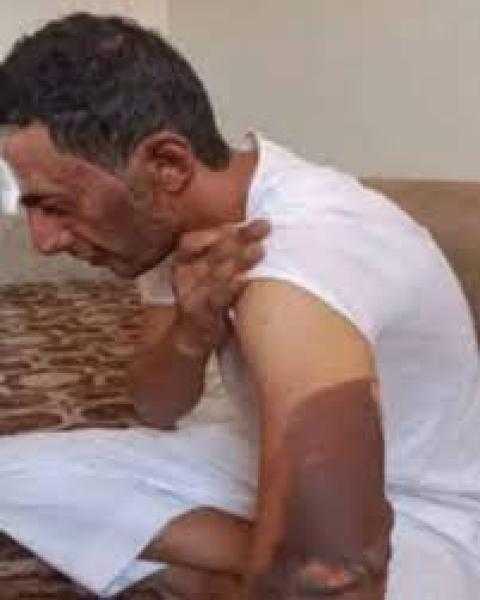 رغم إصابته.. سعودي ينقذ طفلا مصريا من موت محقق داخل حريق «فيديو»