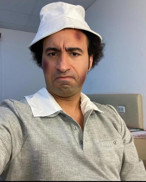 ظهور علي ربيع بكدمات متفرقة في الوجه يثير الجدل على السوشيال ميديا