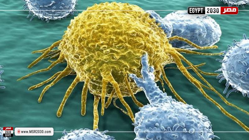 خلايا سرطانية- تعبيرية
