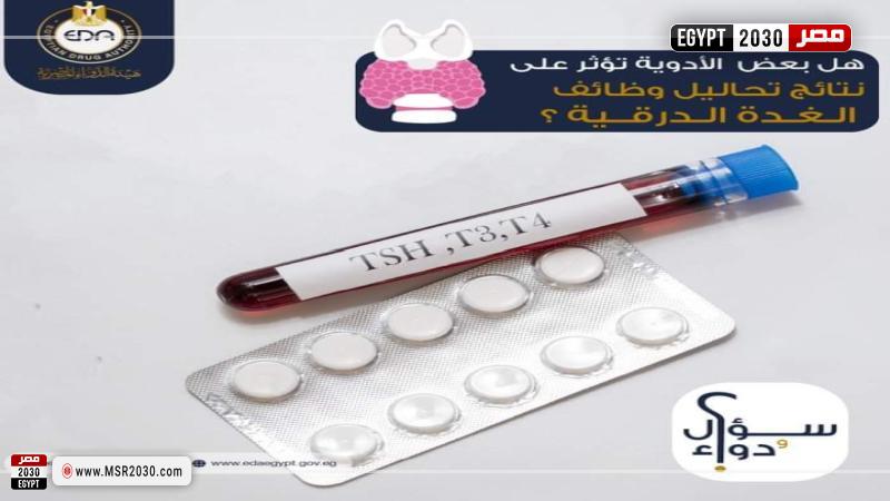 تعبيرية