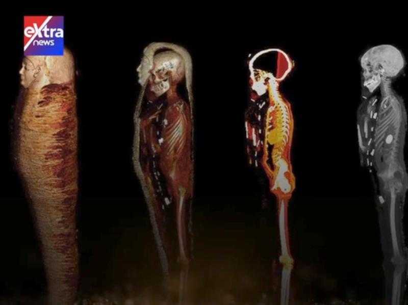 الآشعة المقطعية تكشف أسرار مومياء «الصبي الذهبي».. فيديو