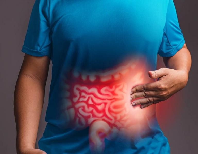 طبيب: السبب الحقيقي للإصابة بالقولون العصبي ما زال مجهولاً.. «فيديو»