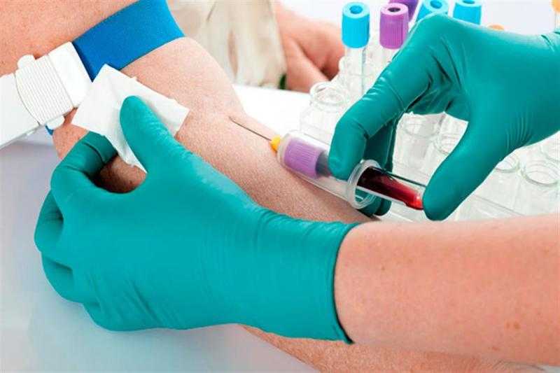 بعد إضافة تعديلات جديدة.. التكلفة الكاملة للفحوصات الطبية للمقبلين على الزواج