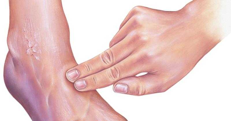 حسام موافي يكشف علاقة التصلب الجلدي بـ الغرغرينا