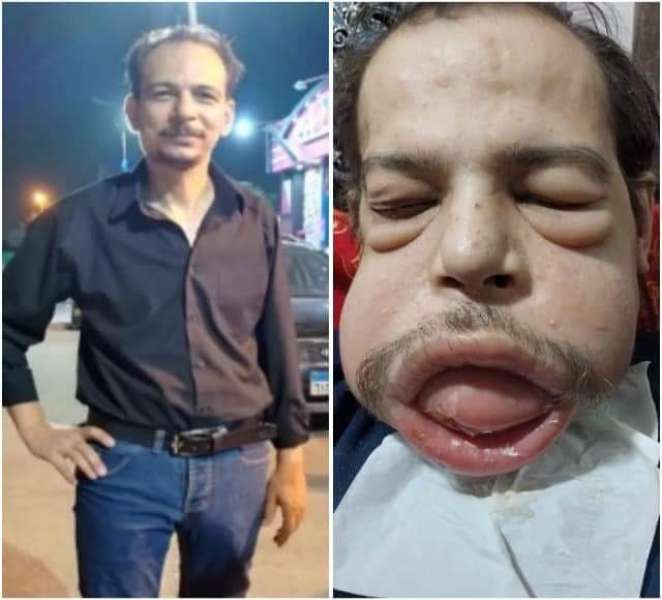 عم وليد ضحية الخطأ الطبى