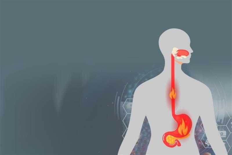 ارتجاع المرئ.. الأسباب والأعراض وطرق العلاج