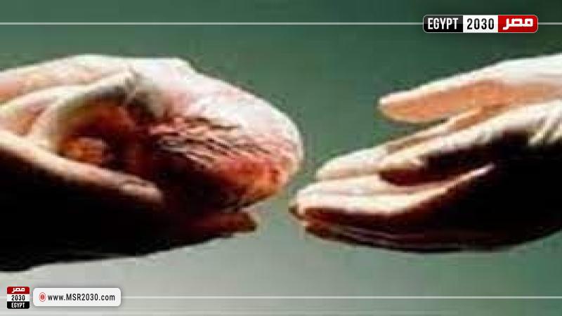 التبرع بالأعضاء 