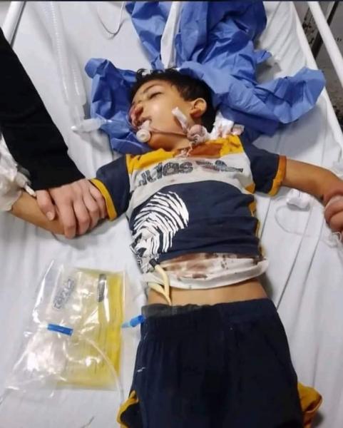 «لعبة الموت».. الطائرة الورقية تطيح بطفل من الدور الخامس بالبحيرة