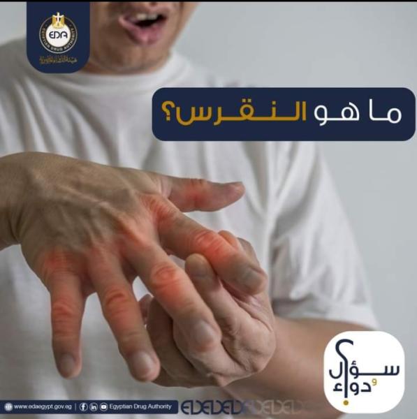 تعبيرية 