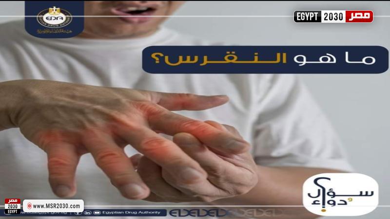 تعبيرية
