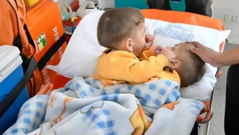 القصة الكاملة للتوأم السيامي السوري إحسان وبسام