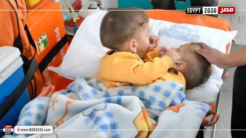 التوأم السيامي السوري