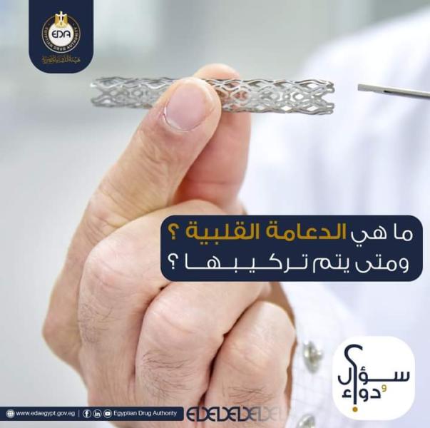 تعبيرية 