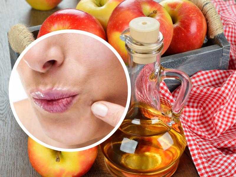 يخلصك من التجاعيد وحب الشباب.. تعرفي على فوائد الخل للبشرة
