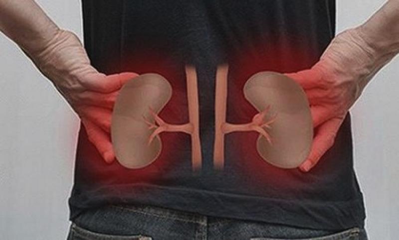 تعبيرية