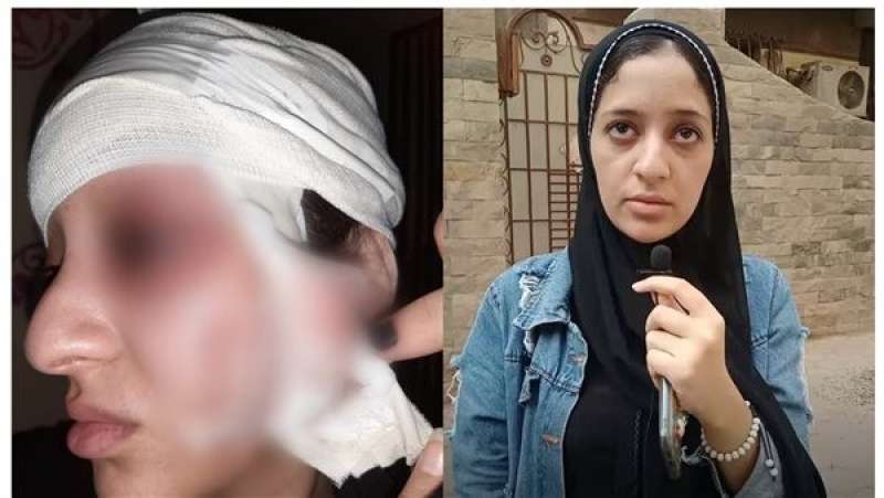 الفتاة المتضررة