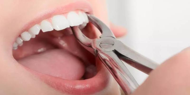 حكم بيع أسنان الإنسان المخلوعة للأطباء وطلاب كليات الطب