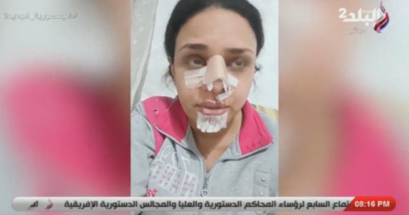 أطلقت على زوجها لقب «برنس أحلامي» لكنه تسبب في أذيتها (فيديو)