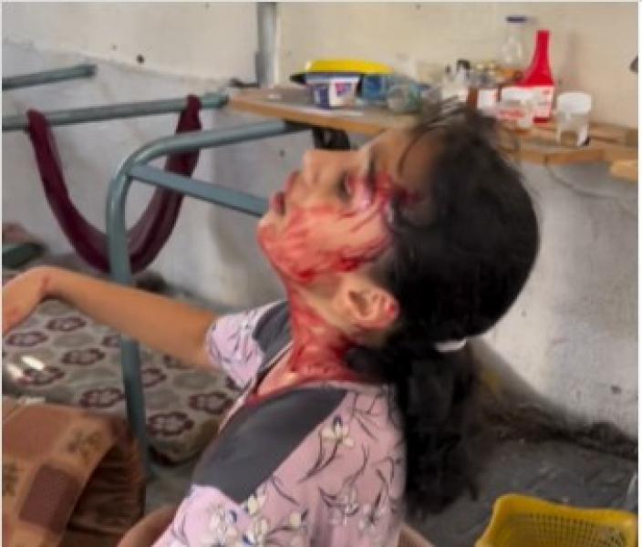 صرخة أطفال غزة تهز القلوب.. الاحتلال يقصف مستشفى الشفاء