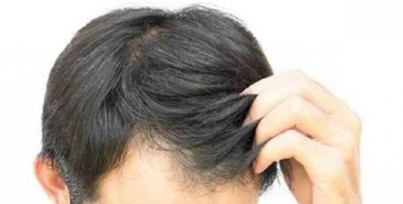 حكم صبغ الشعر باللون الأسود.. الإفتاء توضح