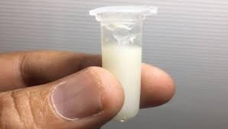 «من الفراعنة حتى نابليون وكاسترو».. جرائم القتل بالسم تاريخ ممتد من قديم الأزل