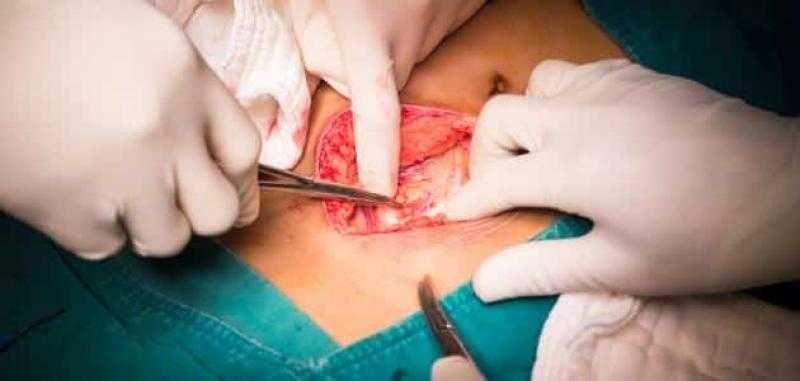 تأمين الفيوم الصحي يرفض إجراء عملية زائدة دودية لطالبة