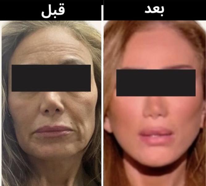 ريهام سعيد 
