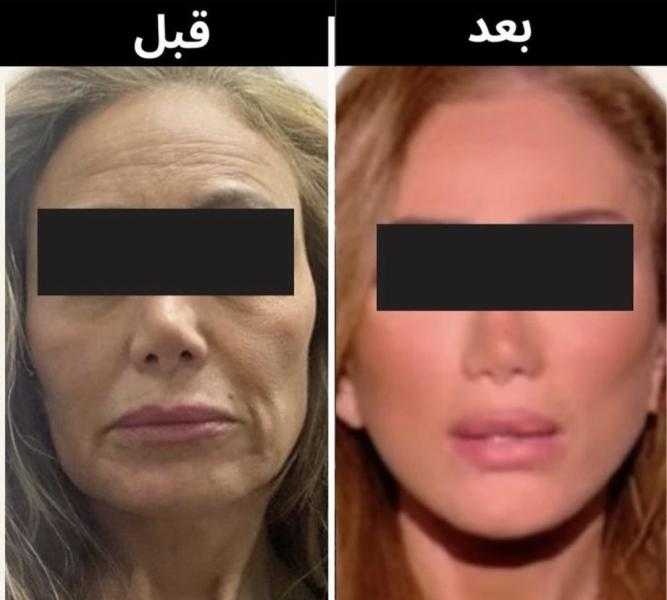 عاجل.. ريهام سعيد تهاجم دكتور تجميل تسبب في تشوه وجهها