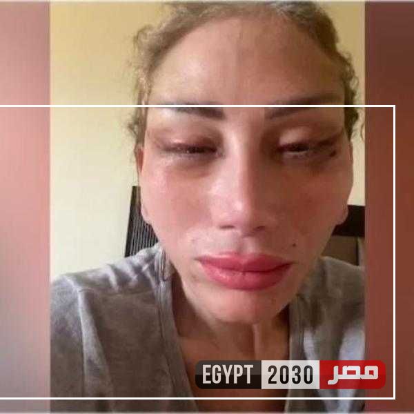 بعد عملية التجميل.. تسريب تسجيل صوتي صادم يتهم ريهام سعيد بالنصب
