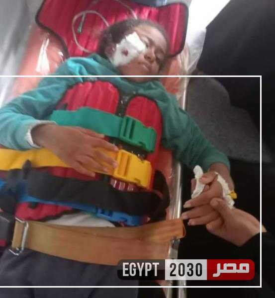 إصابة طفلة بكسر مضاعف إثر سقوط عمود إنارة عليها.. ومحافظ أسوان يتدخل