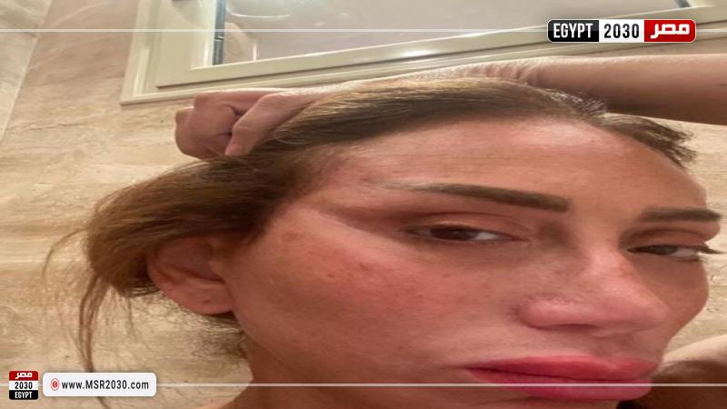 أحدث ظهور لريهام سعيد بعد التجميل
