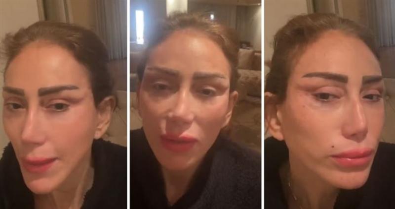 ريهام سعيد بوجه مفتوح داخل غرفة العمليات