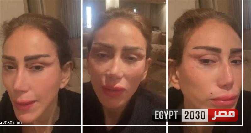 بوجه مفتوح.. شاهد أول فيديو للإعلامية ”ريهام سعيد” داخل غرفة العمليات