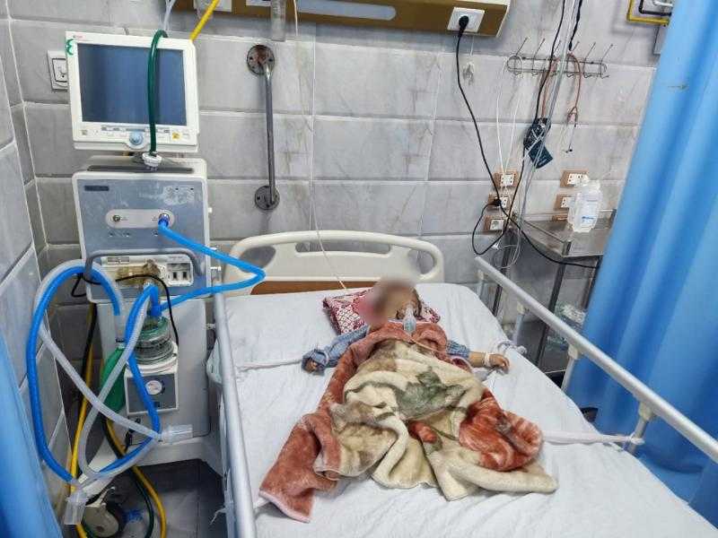 الفريق الطبي بمستشفى الزقازيق العام ينجح في إنقاذ حياة طفل