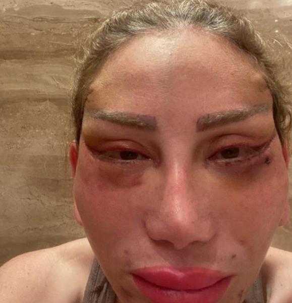 ريهام سعيد تتهم طبيب تجميل لبناني بـ«هتك عرضها».. اعرف التفاصيل