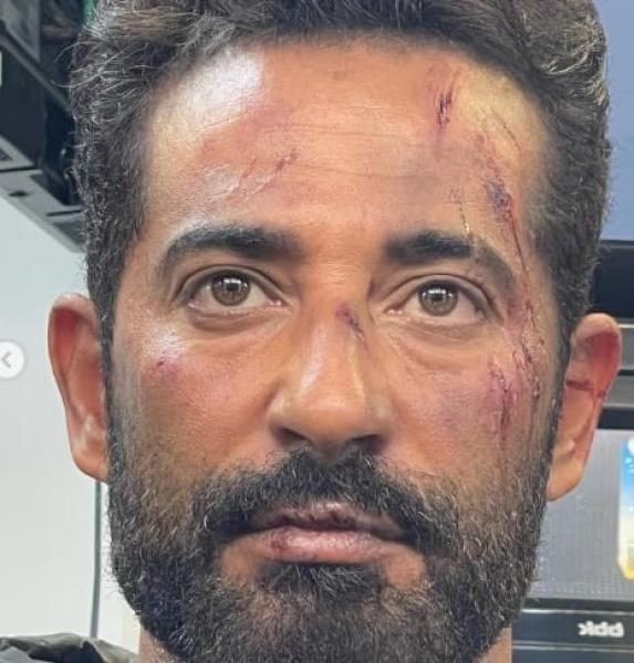 إصابة الفنان عمرو سعد في معارك «الغربان»
