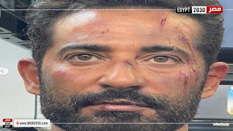عمرو سعد من فيلم الغربان