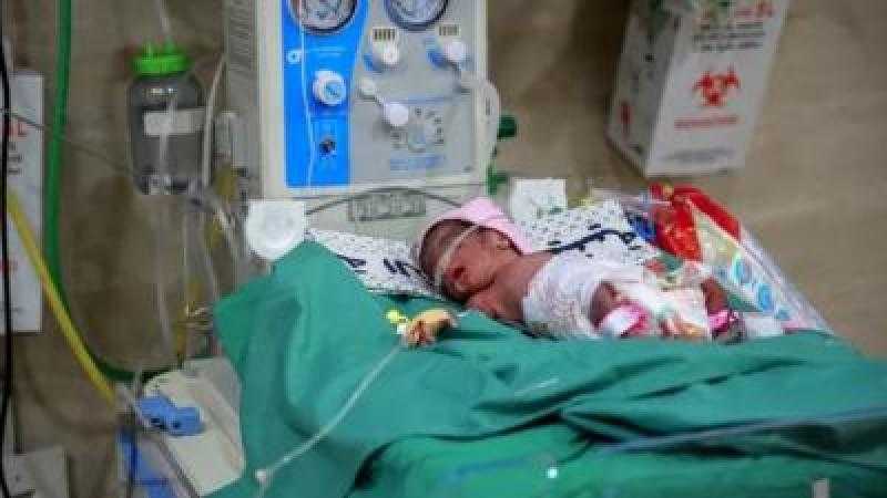 وفاة رضيعين نتيجة الجفاف في مستشفى كمال عدوان