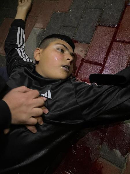 استشهاد طفل فلسطيني برصاص الاحتلال الإسرائيلي
