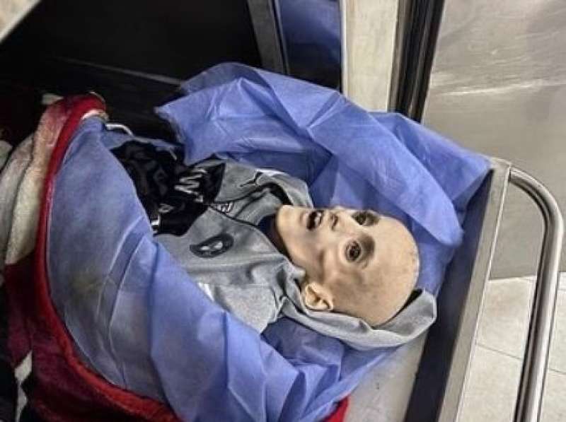 الطفل يزن الكفارنة