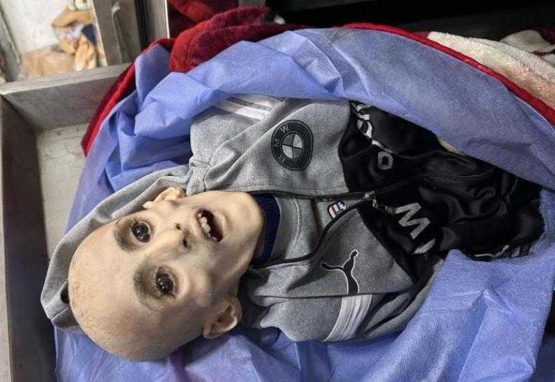 «الصحة الفلسطينية »:27 طفلا استشهدوا جراء التجويع