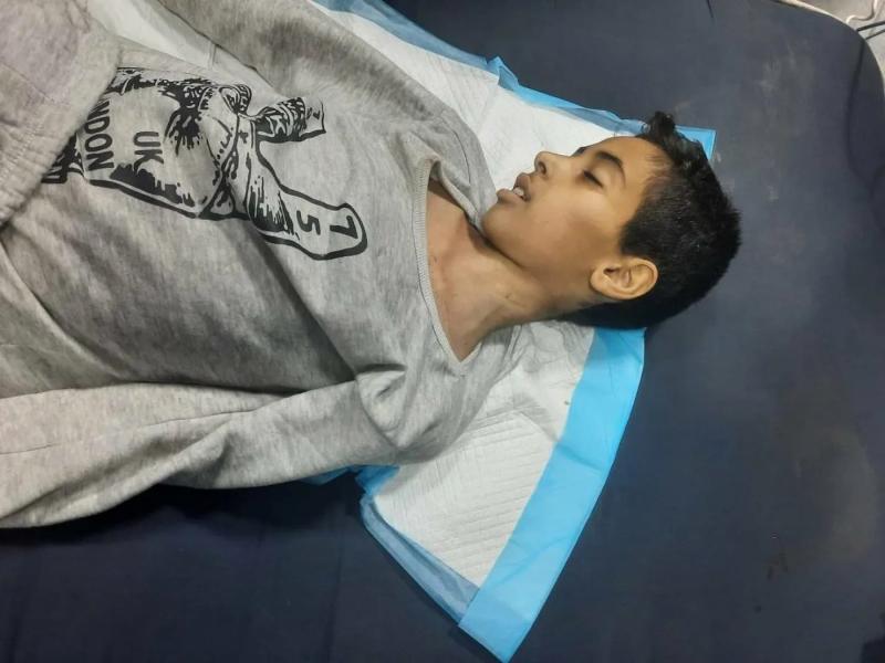 استشهاد 4 فلسطينيين جراء سوء التغذية في غزة