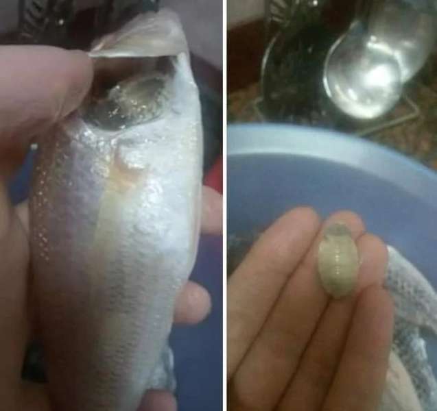 تعبيربة