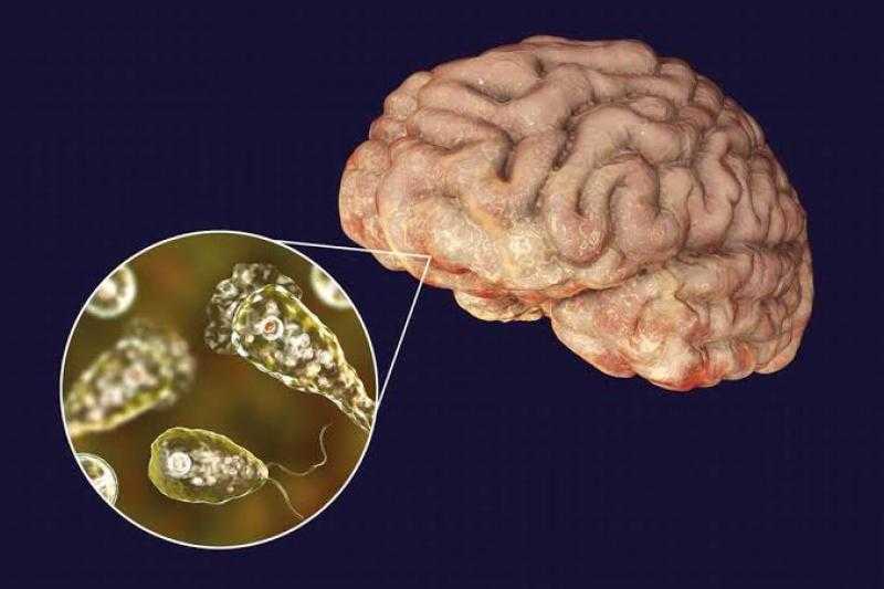 بعد ظهور ”الأميبيا آكلة الدماغ” في إسرائيل.. ماذا تعرف عن العدوى القاتلة؟