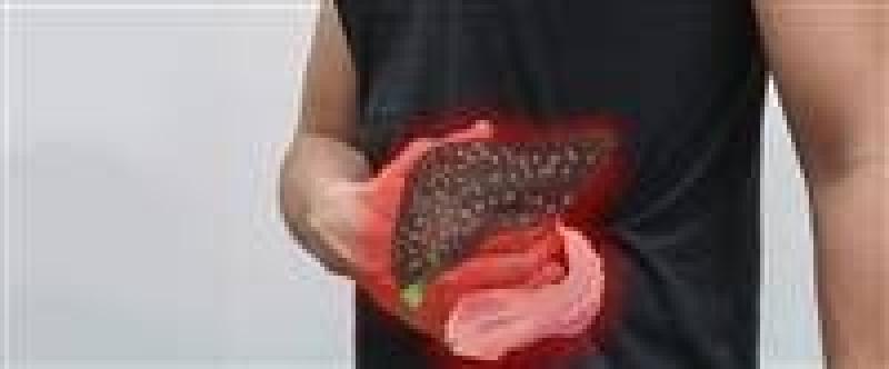 التهاب الكبد 