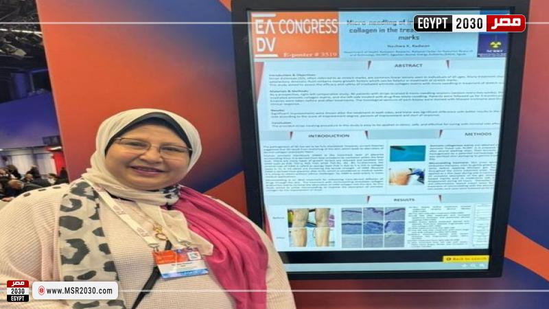 نشوة رضوان استاذ بالمركز القومي لبحوث وتكنولوجيا الإشعاع