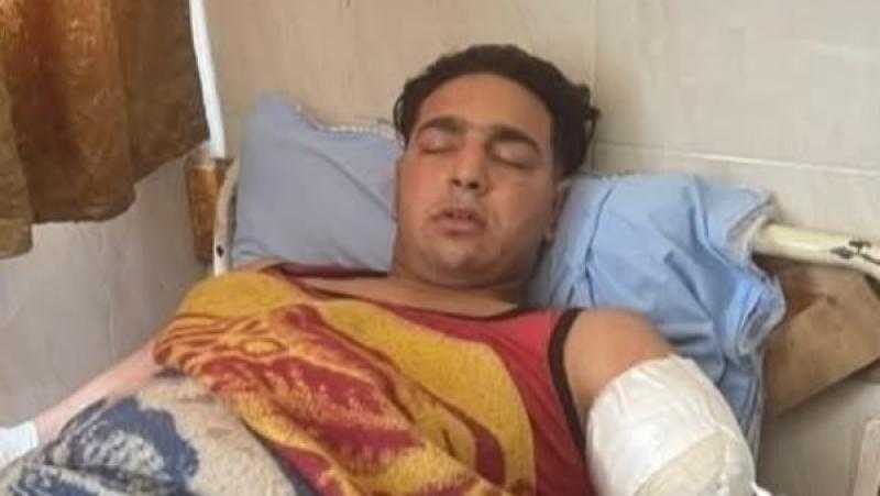 التفاصيل الكاملة لبتر ذراع عامل السيرك بعدما هاجمه أسد مفترس في طنطا